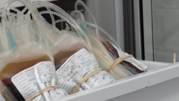 Sacche sangue
